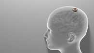 Para neurocientistas, segurança deve ser a prioridade nessa fase de ensaios do chip cerebral, mas faltam informações, como o local dos testes
